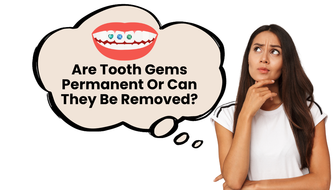 Are Tooth Gems Permanent Or Can They Be Removed?